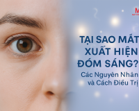 Tại Sao Mắt Xuất Hiện Đốm Sáng? Các Nguyên Nhân và Cách Điều Trị